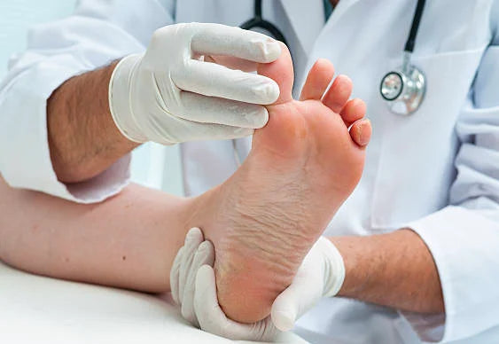 3D Bunion Splint Corrector Device